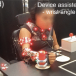 Expanding functional workspace for people with c5-c7 spinal cord injury with supernumerary dorsal grasping